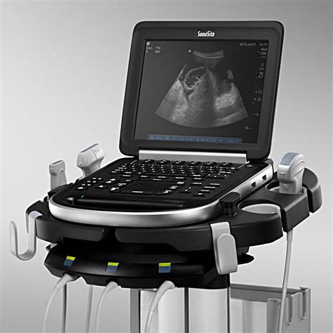 sonosite edge ultrasound system scanner machine box  package  diagnostic ultrasound