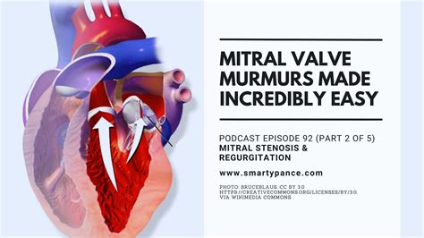 podcast episode  murmurs  incredibly easy part    mitral