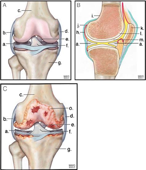 anterior a and lateral b views of a healthy knee joint showing the