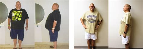 Michael S Weight Loss Transformation St Louis Bariatrics