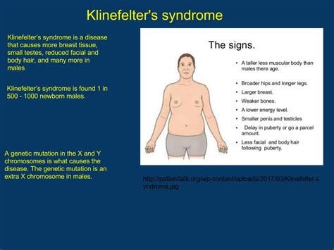 History Of Klinefelter Syndrome Captions Cute Today