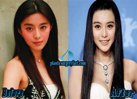 Fan Bingbing Plastic Surgery Before And After Photos