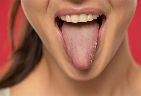 healthy tongue      northwell