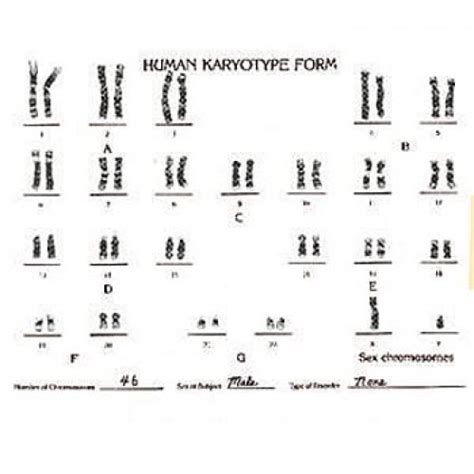 Types Of Human Chromosome Abnormalities Biokit®