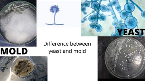 difference  yeast  mold microbe