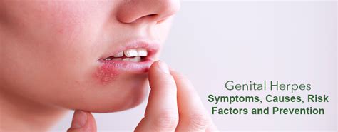 genital herpes symptoms causes risk factors and