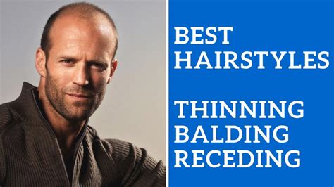 best hairstyles for thinning crown for men wavy haircut
