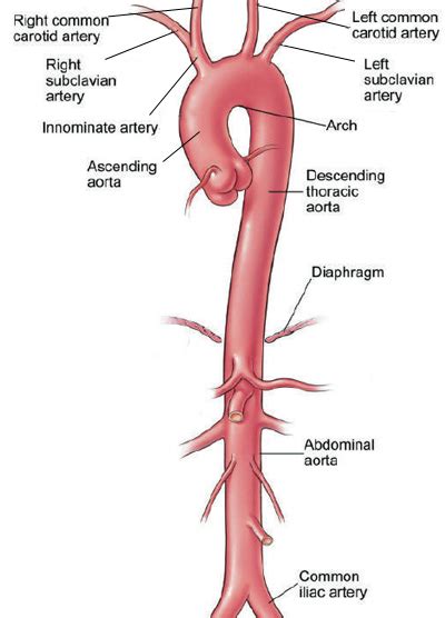 thoracic aortic aneurysm surgery cleveland clinic health library