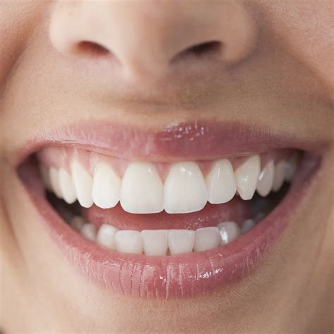 tips  dentists  whitening  teeth  treatment good housekeeping