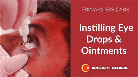 instilling eye drops  ointments  primary eye care youtube