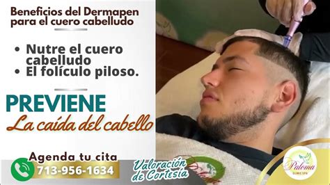 dermapen  cuero cabelludo en paloma clinic spa houston texas