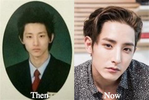 Lee Soo Hyuk Plastic Surgery Before And After Photos