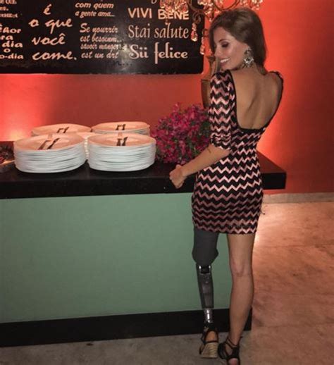 paola antonini frança costa poses with her prosthetic leg to empower