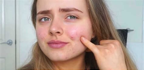 study finds women experience  bad skin days  year littlethingscom