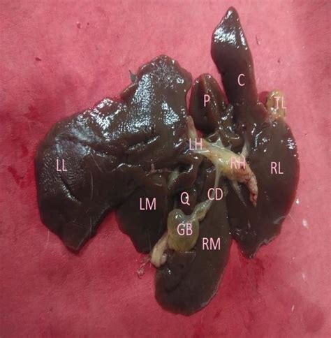 Showing The Ventral Surface Of Liver With Right Lateral Rl Right