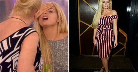 Nicola Mclean Reveals She S Nearly Blind In One Eye Weeks After Being