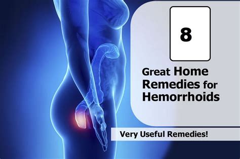 8 Natural Home Remedies For Hemorrhoids Nikihow How To Find Best