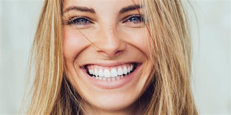 brighten your smile with professional teeth whitening