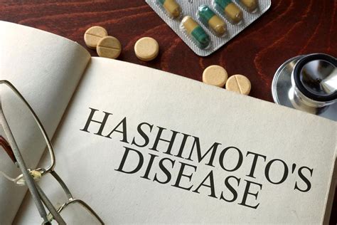 infopandanet   symptoms  hashimotos disease