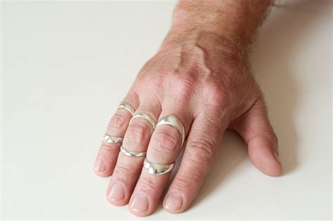 we design finger splints