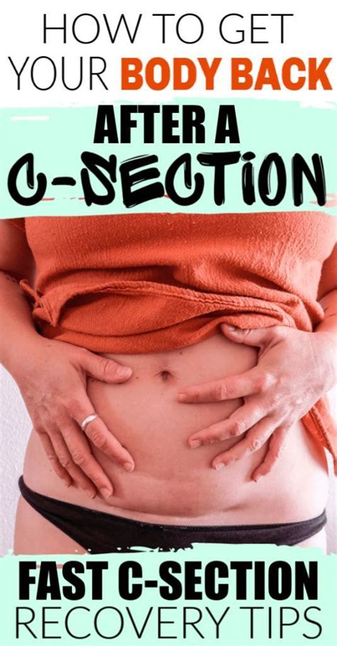 12 C Section Recovery Tips To Heal Fast C Section Recovery C Section