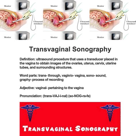 transvaginal sonography