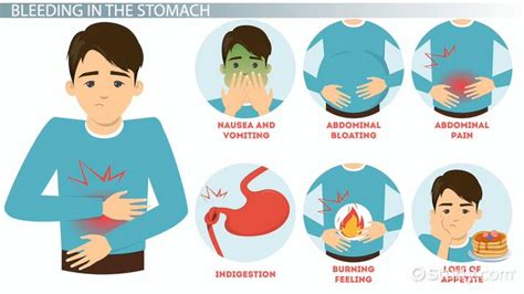 Internal Stomach Bleeding Causes Symptoms And Treatment Lesson