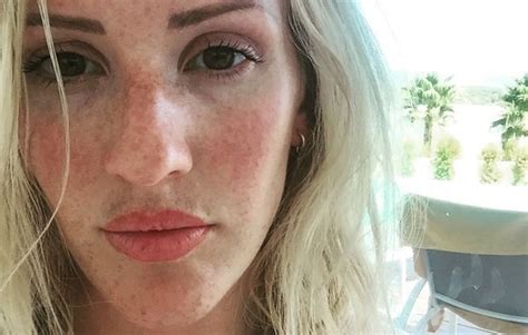 your freckles actually exist for a scientific reason