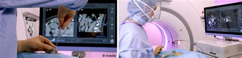 Radiologie Interventionnelle Une Solution Innovante Est Licenciée Par