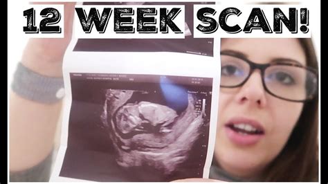 11 12 weeks pregnancy symptoms 12 week dating scan kerry conway