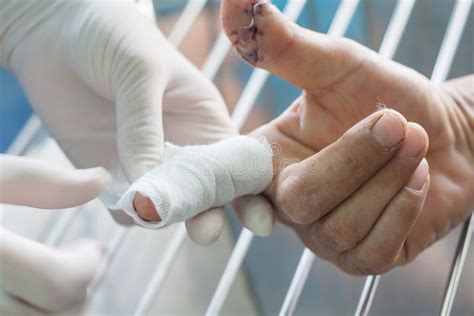 Cutting Finger Wound Stock Image Image Of Cure Operation 155615899