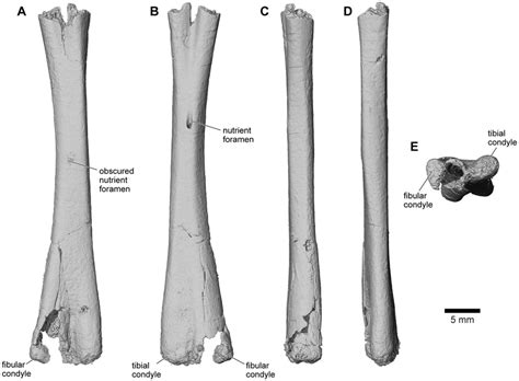 tibiofibula ua   anterior  posterior  lateral   scientific