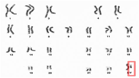 Y Chromosome Is Important For More Than Just Sex And Reproduction