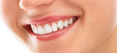 receding gums  prevention  healing guide healthrownet