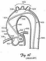 Patent Patentsuche Bilder Coronary sketch template