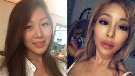K Pop Stars Before And After Plastic Surgery