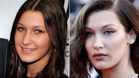bella hadid finally comes clean about having plastic surgery