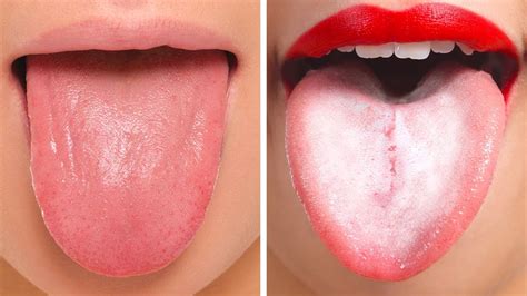 unhealthy healthy tongue images destiny jdb fanfiction