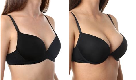 everything you need to know about breast surgery athena plastic surgery
