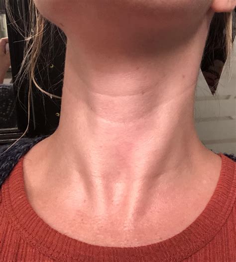 skin concerns ive started  develop   deep neck lines