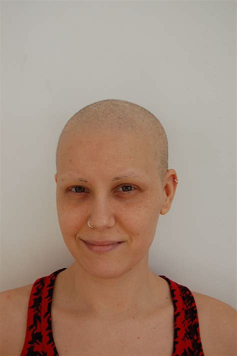 Hair Growth After Chemo One Girl One Head And Her