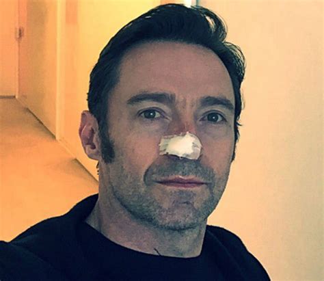 Celebs Hugh Jackman Shows Off Bandaged Nose After Cancer Treatment