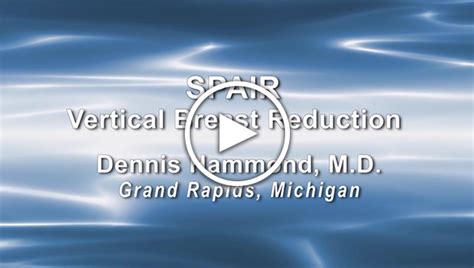 dr dennis hammond spair vertical breast reduction baker gordon