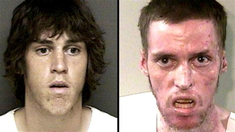 meth s devastating effects before and after
