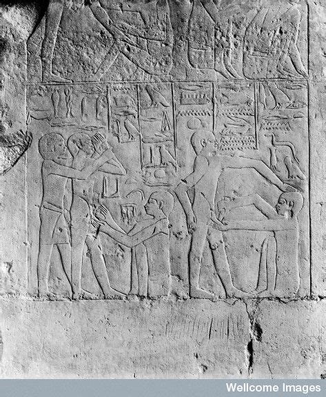 Bas Relief Of Circumcisions Being Performed Found In An Egyptian Tomb