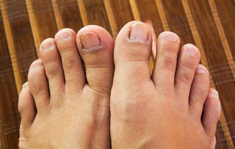 weird things that can happen to your toenails and feet women s health