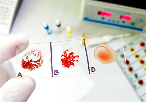 blood type test stock  pictures royalty  images