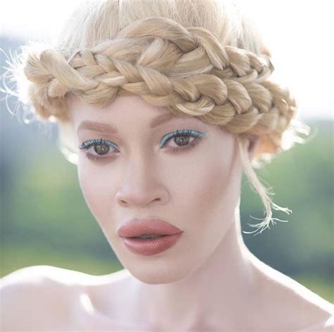 wet n wild chose a model with albinism as the face of its new beauty