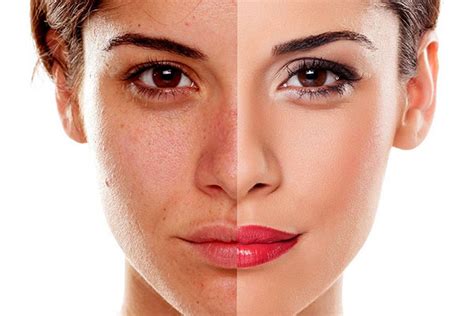 tertipu kosmetik mencerahkan kulit kusam tips kecantikan kesehatan