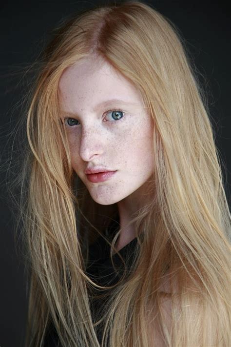 Klaudyna Maciej Bernas I Love Freckles Blonde With Freckles Vogue